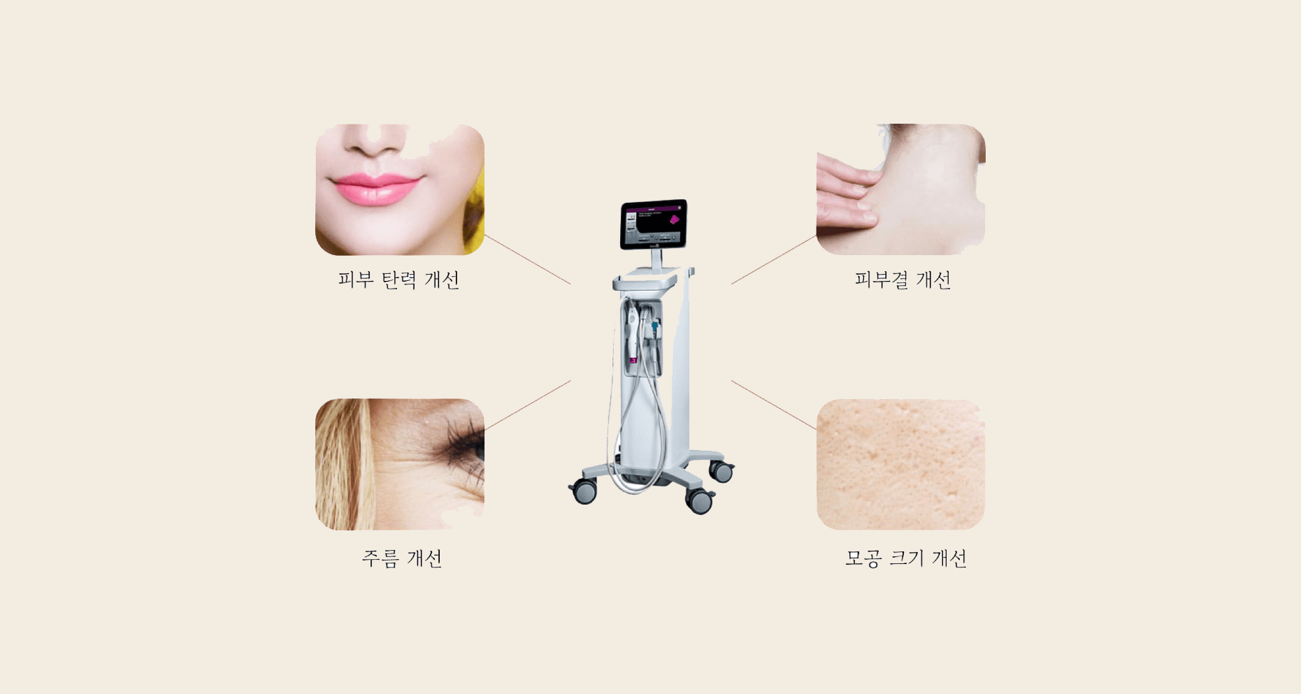 써마지 FLX 효과